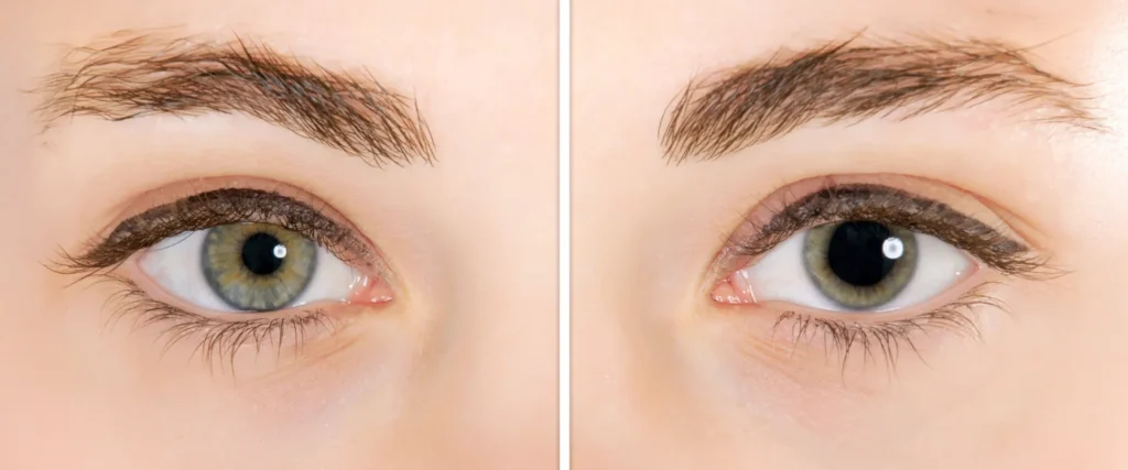 reasons pupils dilate